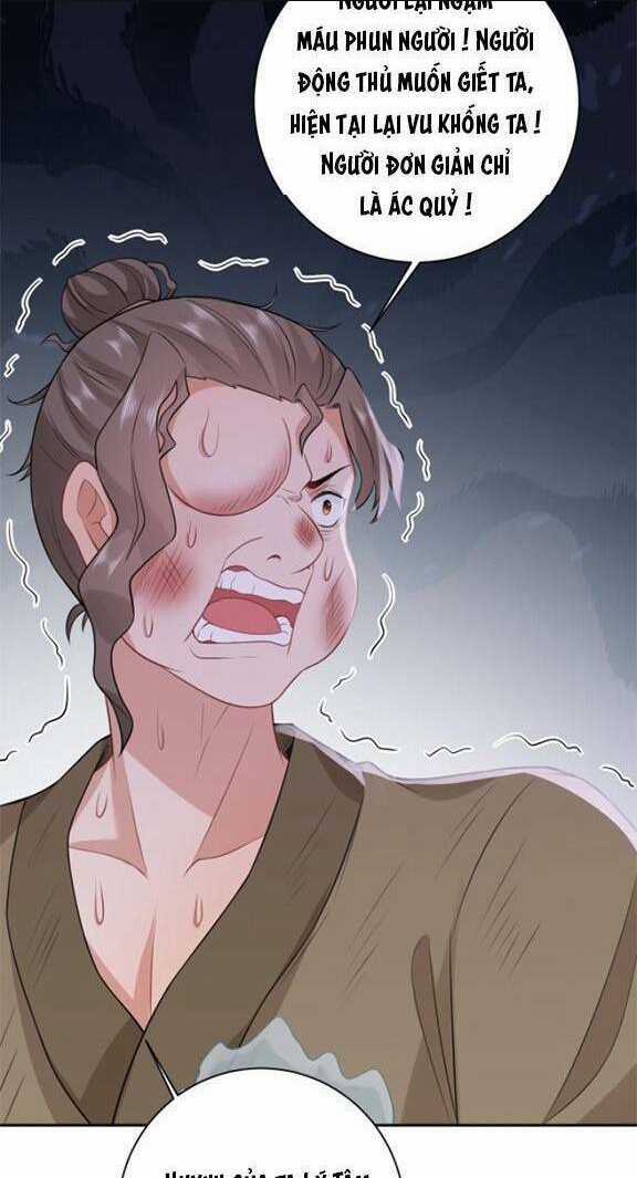 3 KIẾP XUI XẺO, KIẾP NÀY CÙNG TA THẦN KINH Chapter 22 trang 21