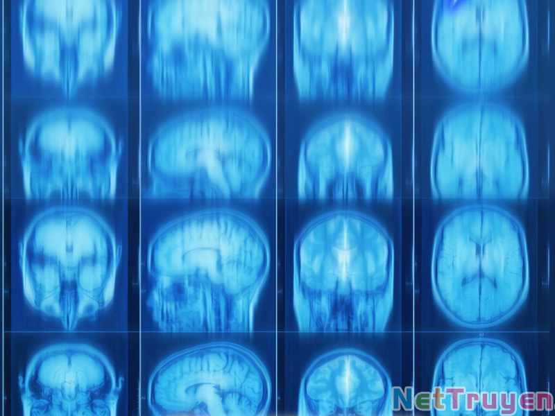 Bác Sĩ Phẫu Thuật Hoàn Hảo Chapter 4 trang 177