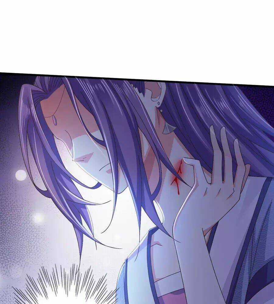 Bạo Quân Thử Yêu: Yêu Hậu Như Thử Đa Kiều Chapter 10 trang 17