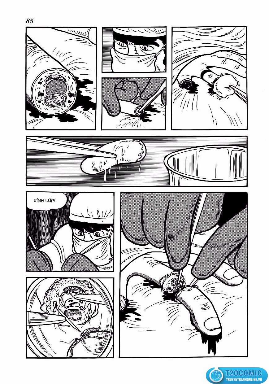 Black Jack Chapter 174 trang 17