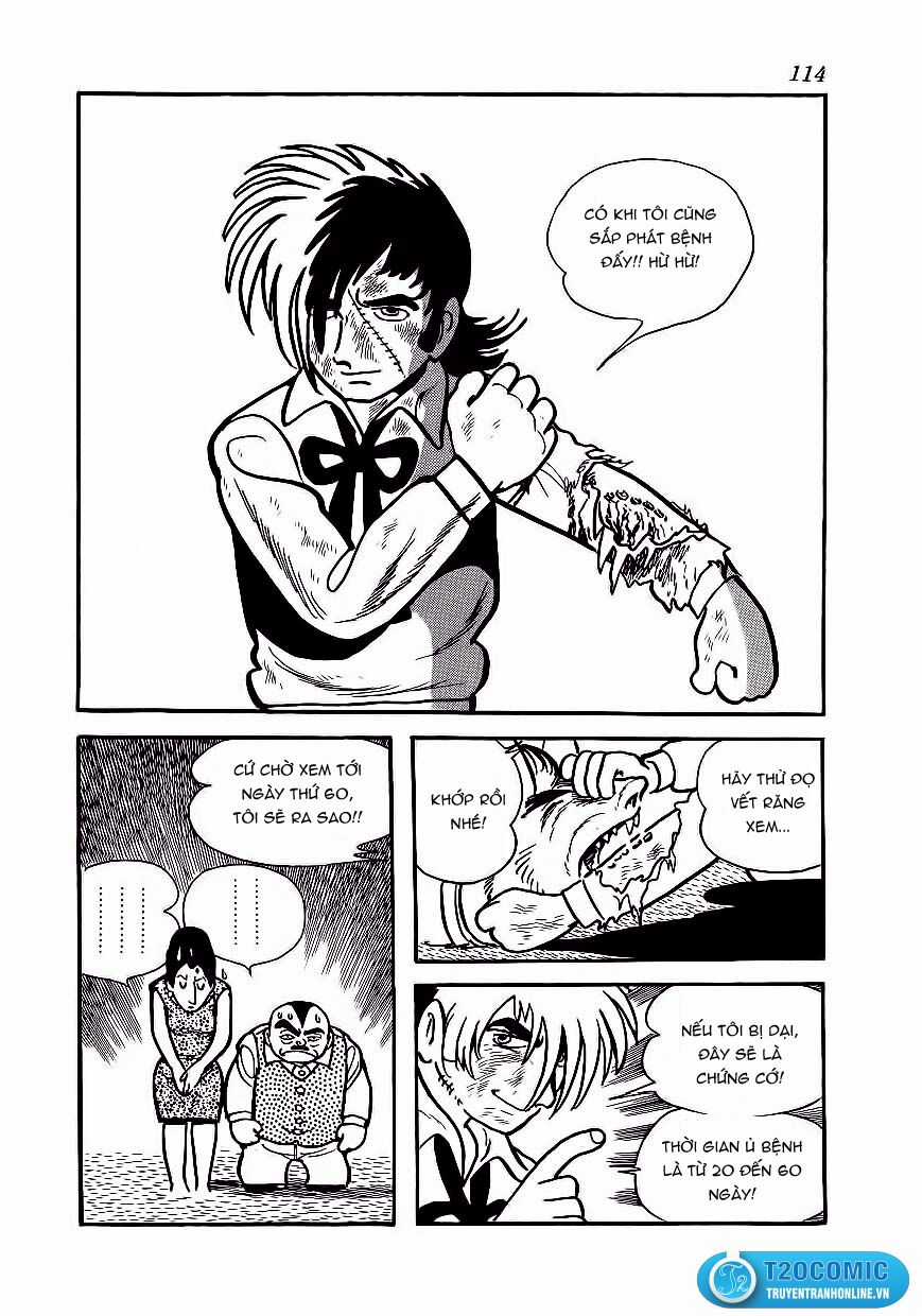 Black Jack Chapter 175 trang 23