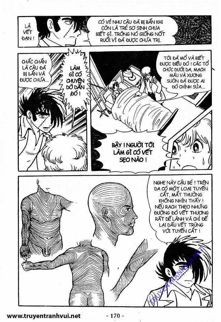 Black Jack Chapter 198 trang 35