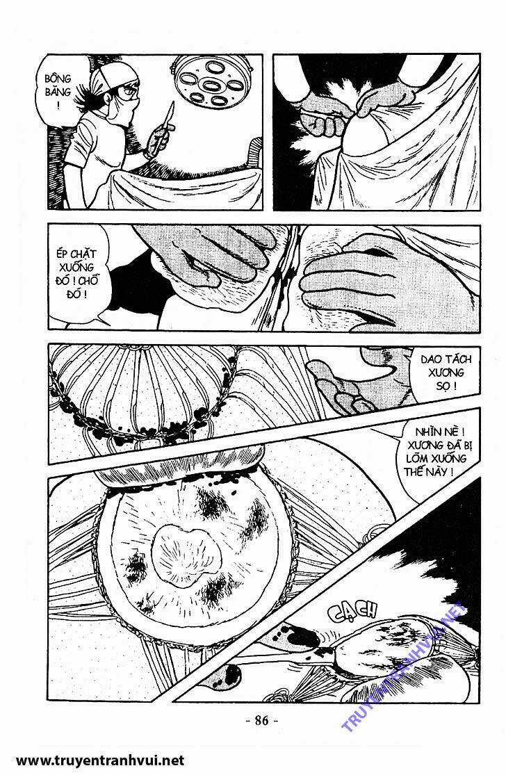 Black Jack Chapter 213 trang 11