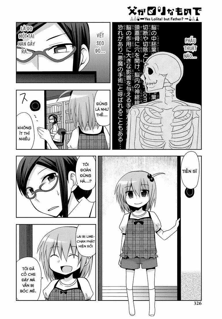 Chichi ga Loli na Mono de Chapter 10 trang 5