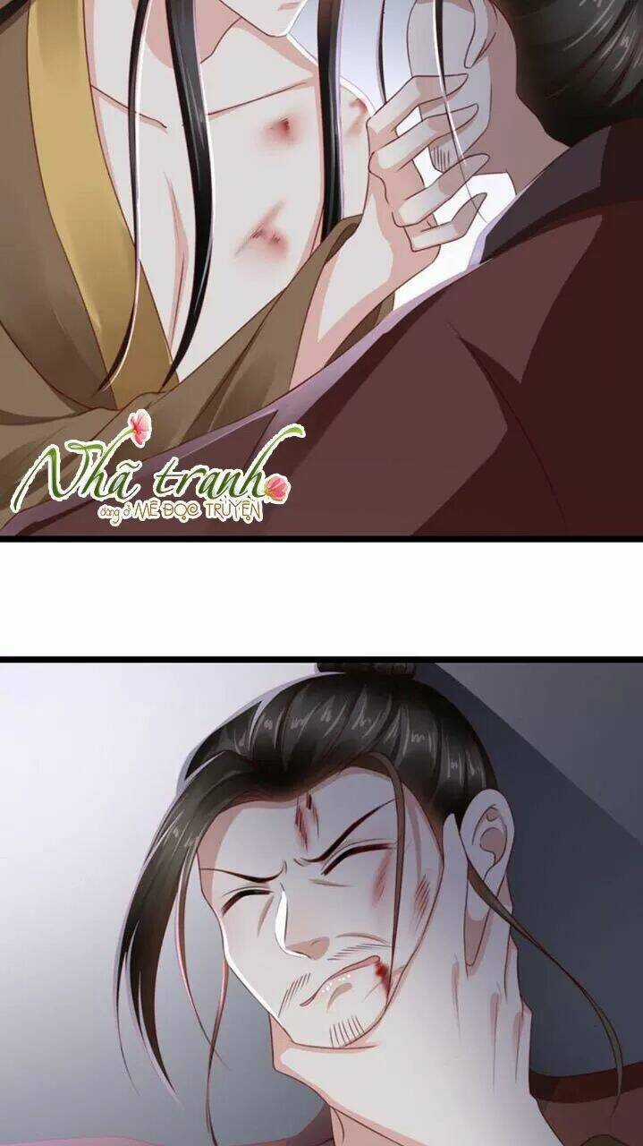 Độc Phi Ngu Ngốc Không Thể Chọc Chapter 117 trang 18