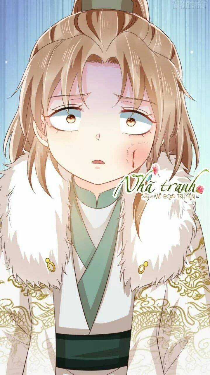 Độc Phi Ngu Ngốc Không Thể Chọc Chapter 152 trang 16