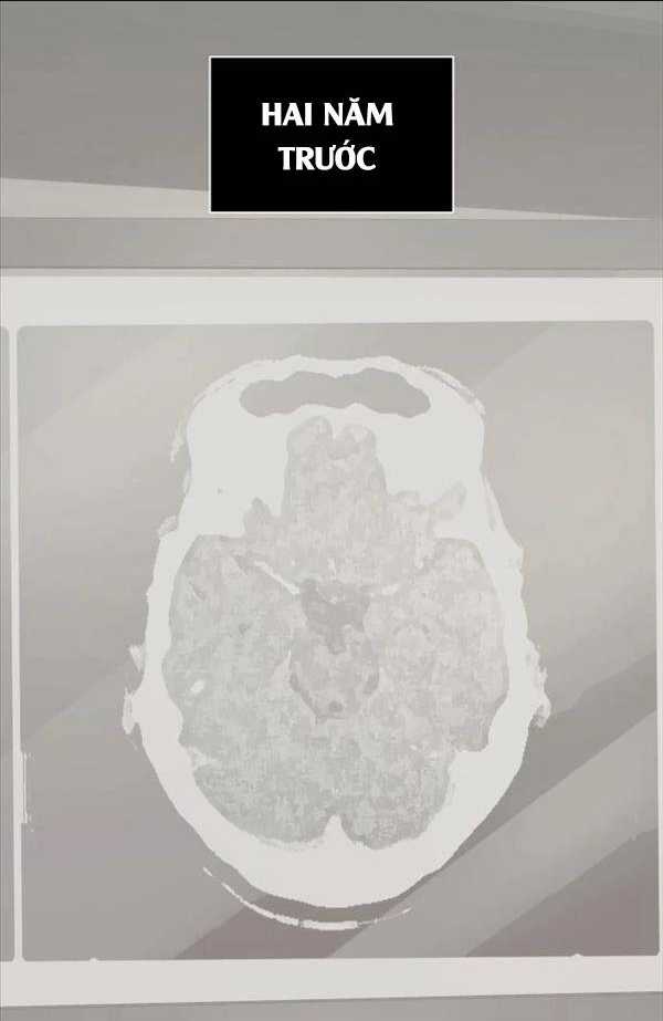 Hắc Kị Sĩ Thiên Tài Giới Hạn Thời Gian Chapter 1 trang 59