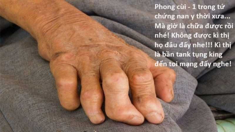 Hổ Đến Chơi Nhà (bản Puchimasu Tự) Chapter 62 trang 68