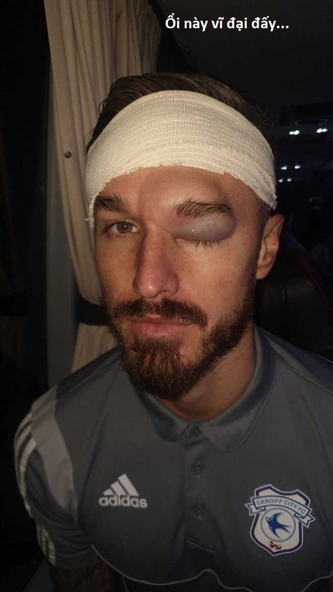 Hổ Đến Chơi Nhà (bản Puchimasu Tự) Chapter 92 trang 76