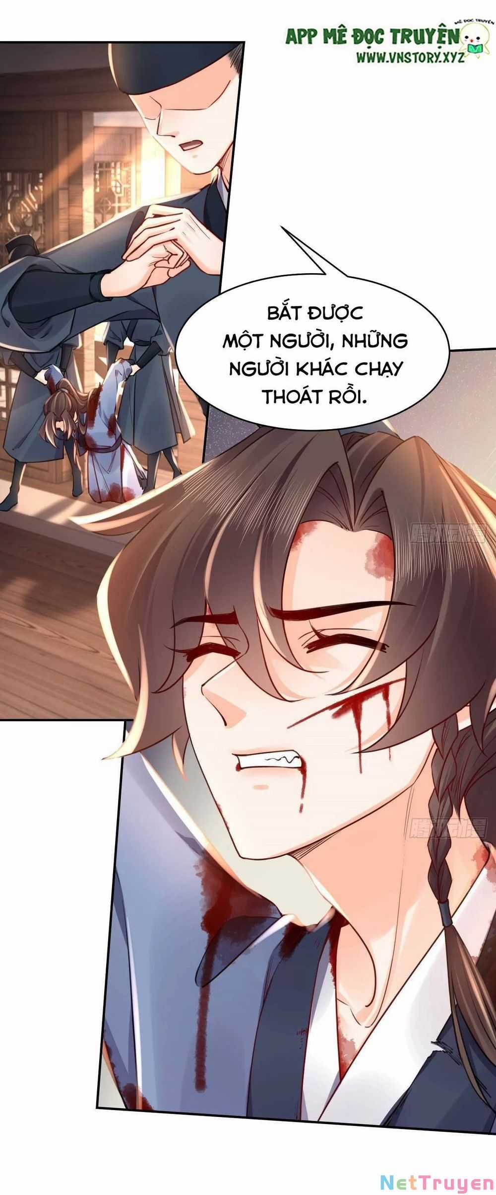 Hoàng Đệ Đừng Nhấc Đao Chapter 57: Lâu ngày gặp lại trang 32