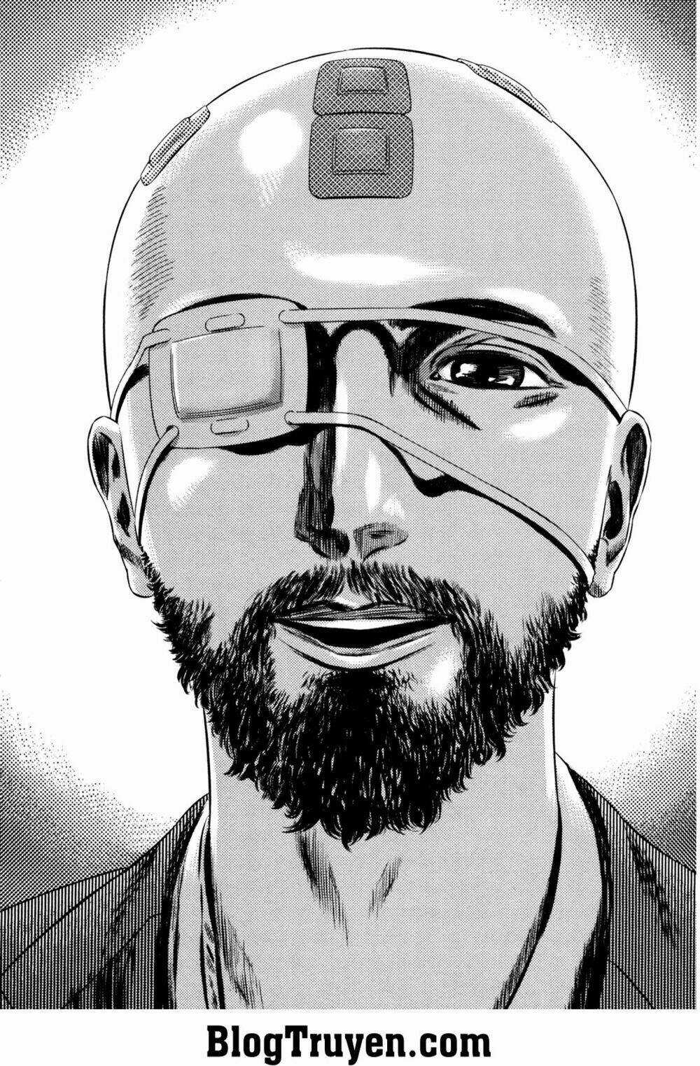 Homunculus Chapter 158 trang 13