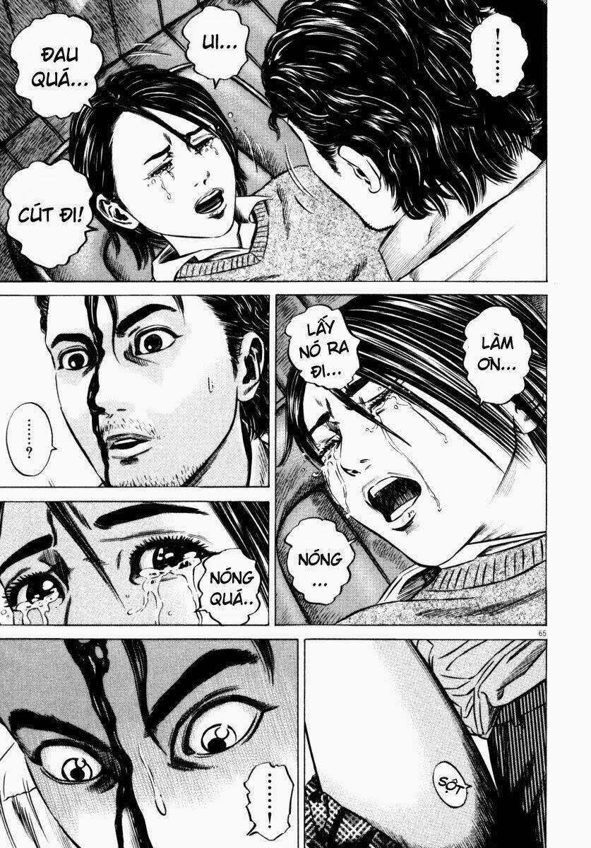 Homunculus Chapter 47 trang 17