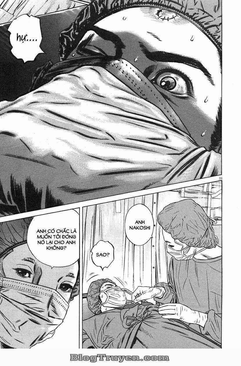 Homunculus Chapter 63 trang 18