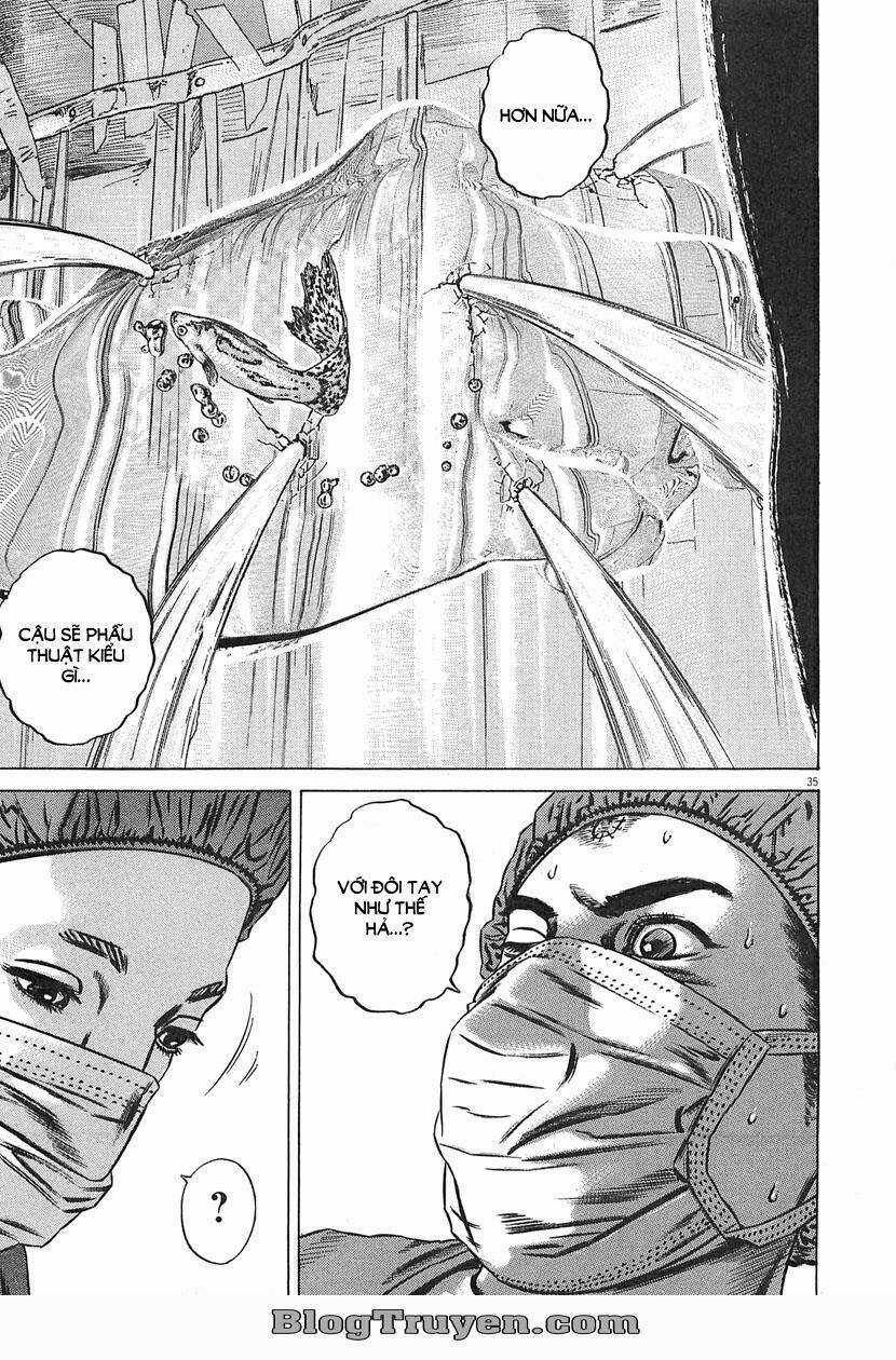 Homunculus Chapter 63 trang 20