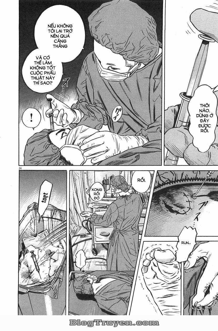 Homunculus Chapter 63 trang 9