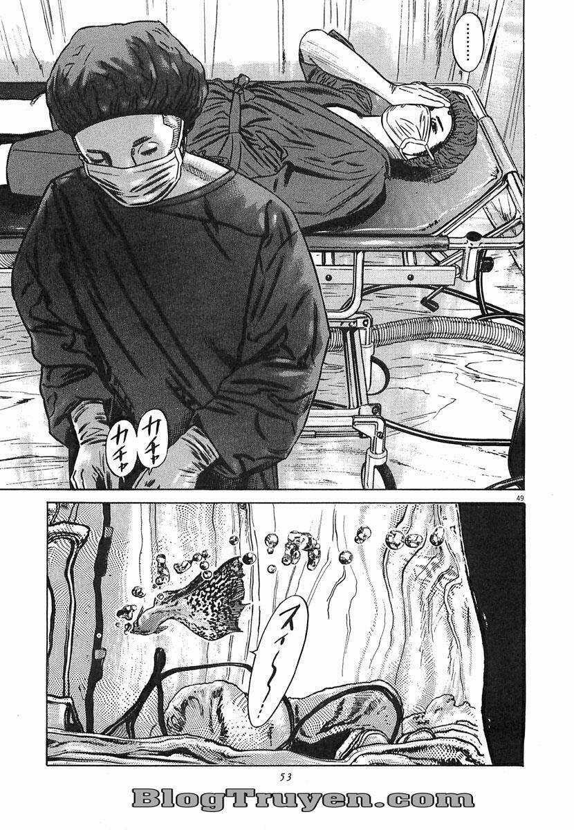 Homunculus Chapter 64 trang 13