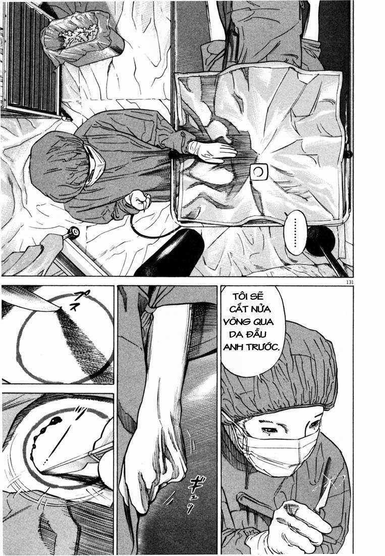 Homunculus Chapter 7 trang 14