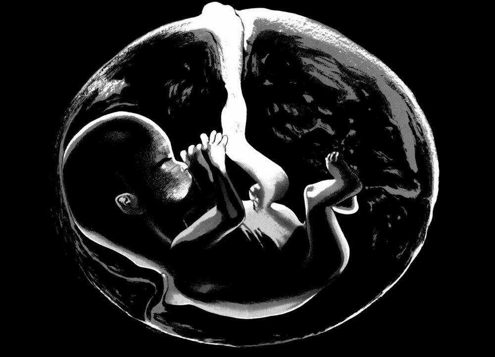 Homunculus Chapter 86 trang 18