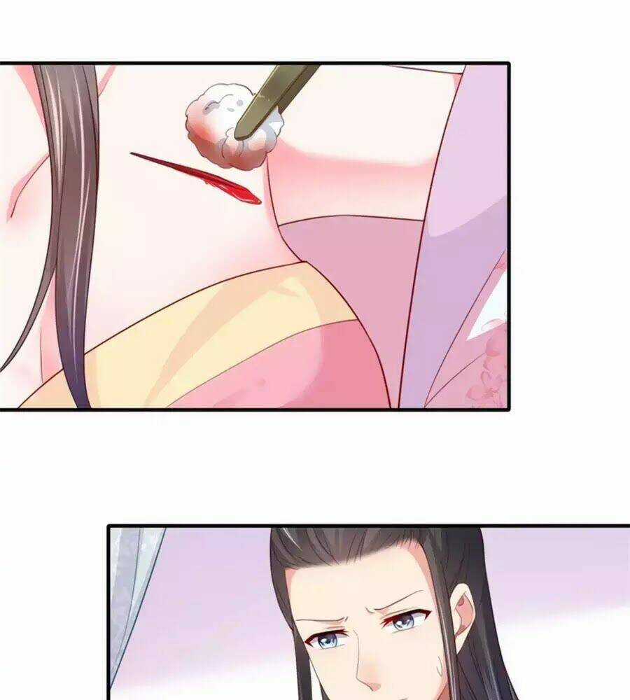 Khuynh Thế Y Phi Muốn Bỏ Chồng Chapter 122 trang 13