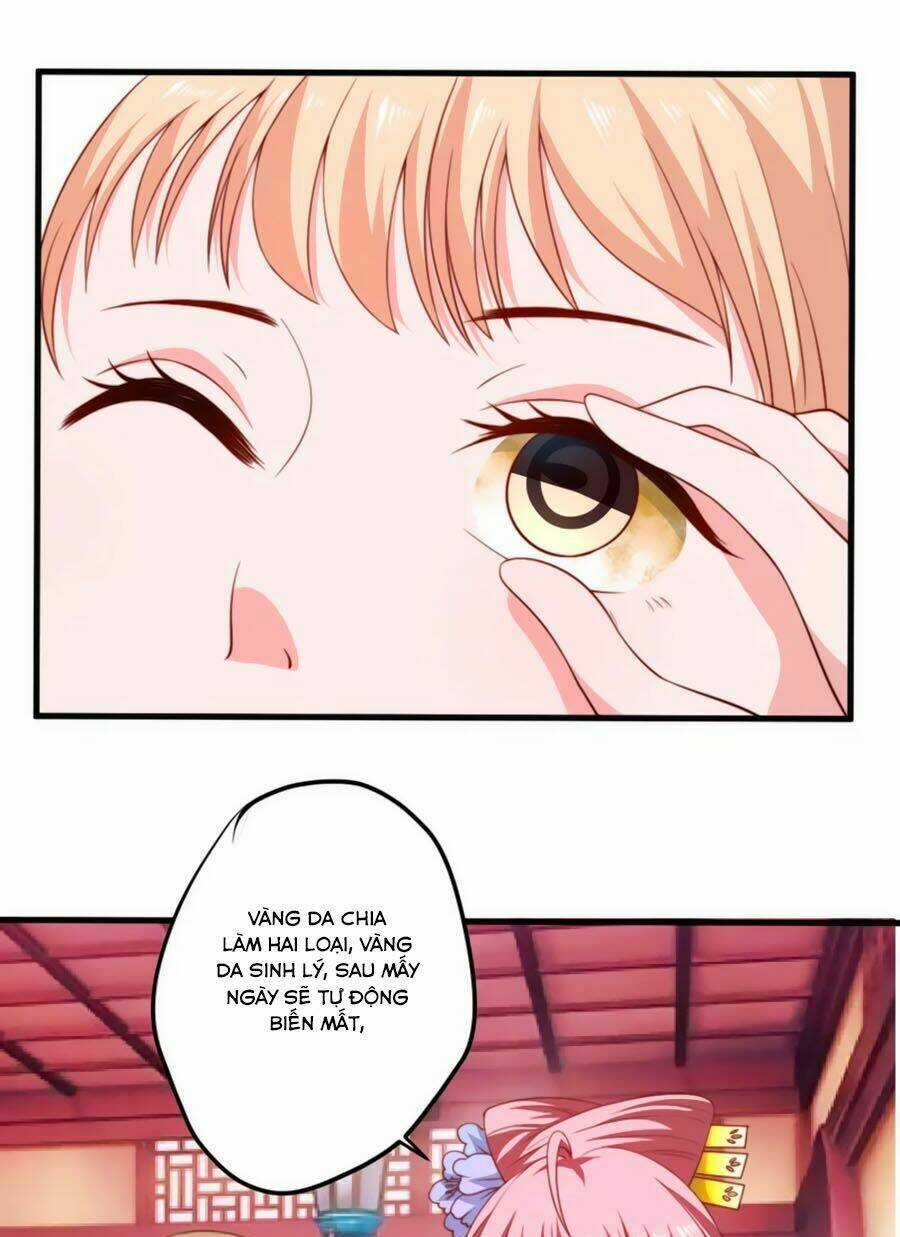 Khuynh Thế Y Phi Muốn Bỏ Chồng Chapter 14 trang 10