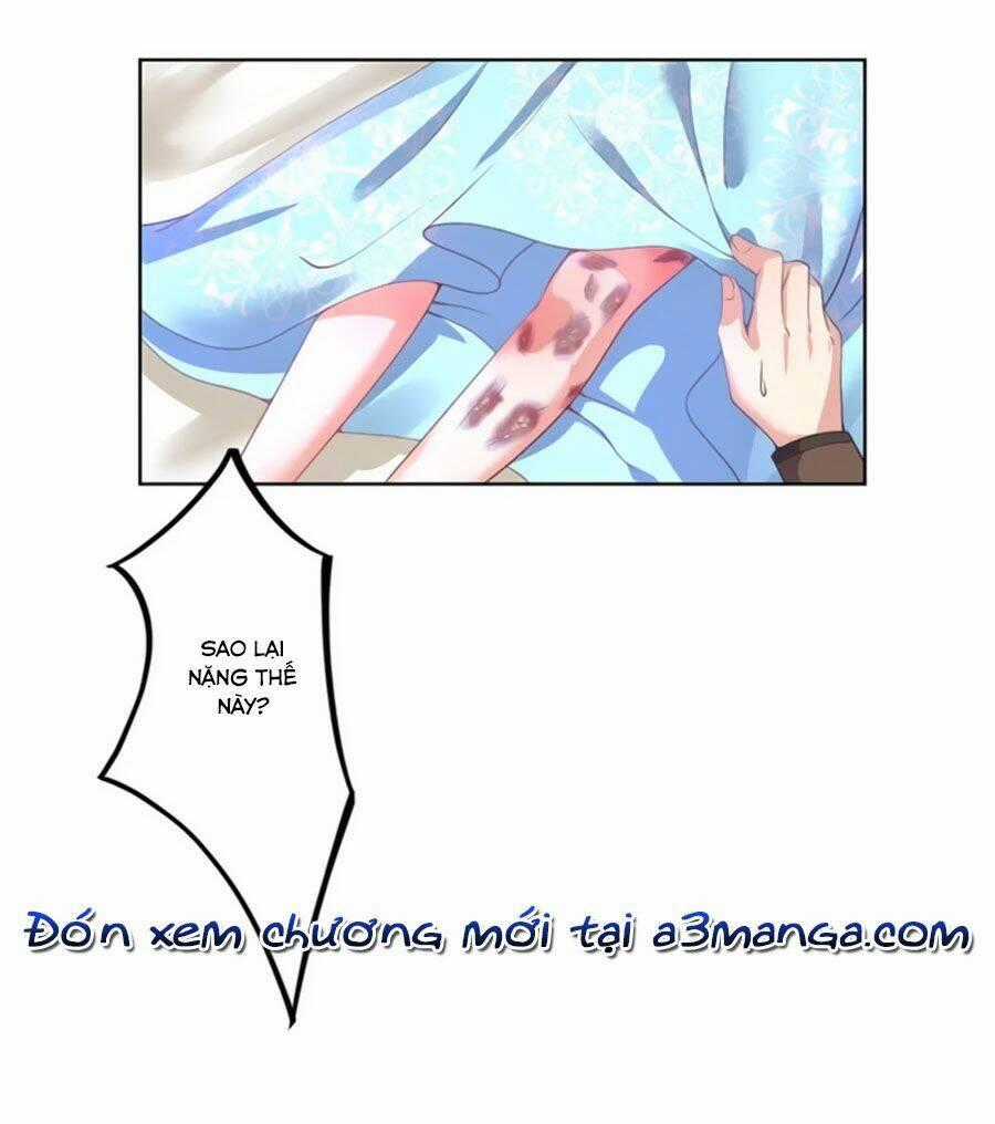 Khuynh Thế Y Phi Muốn Bỏ Chồng Chapter 20 trang 30