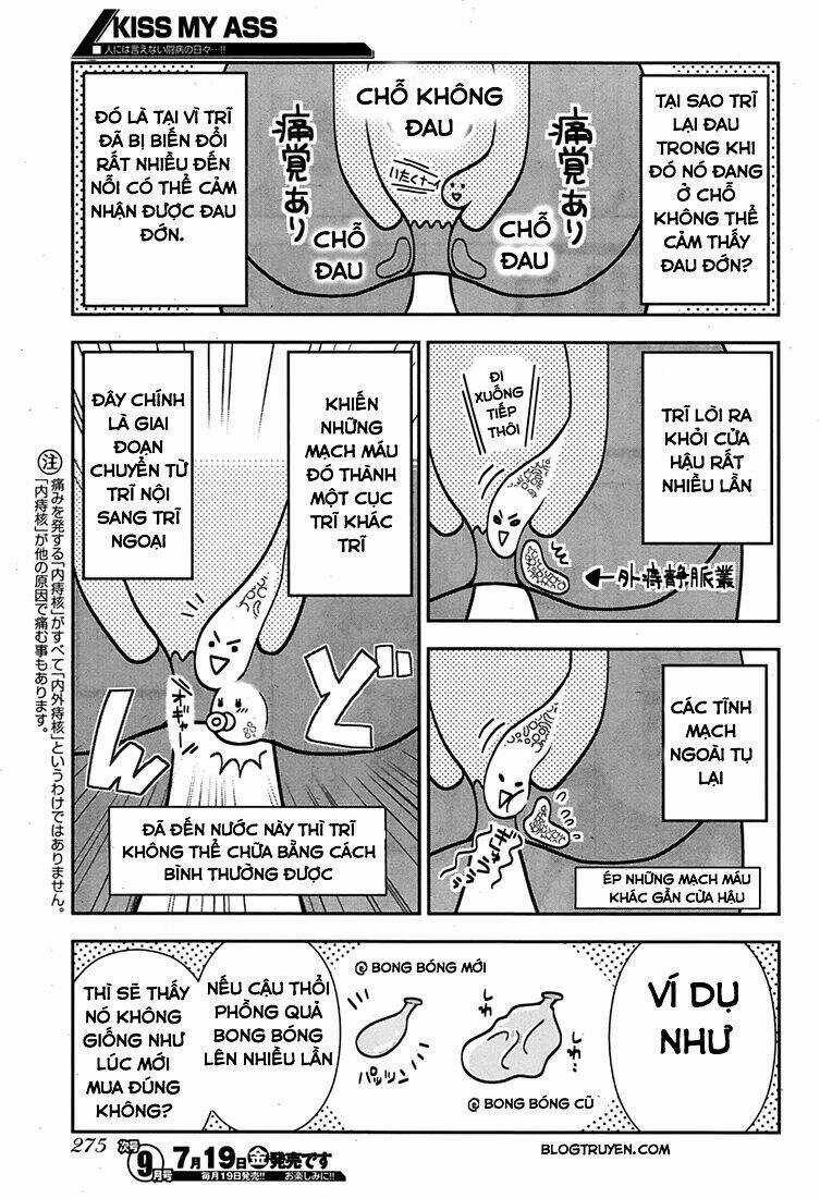 Kiss My Ass Chapter 2 trang 15