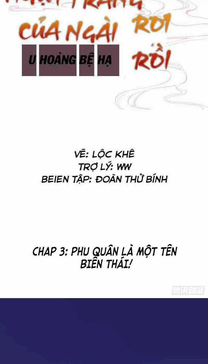 Lại Bị Bệnh Chiều Chuộng Quấn Lấy Chapter 3 trang 1