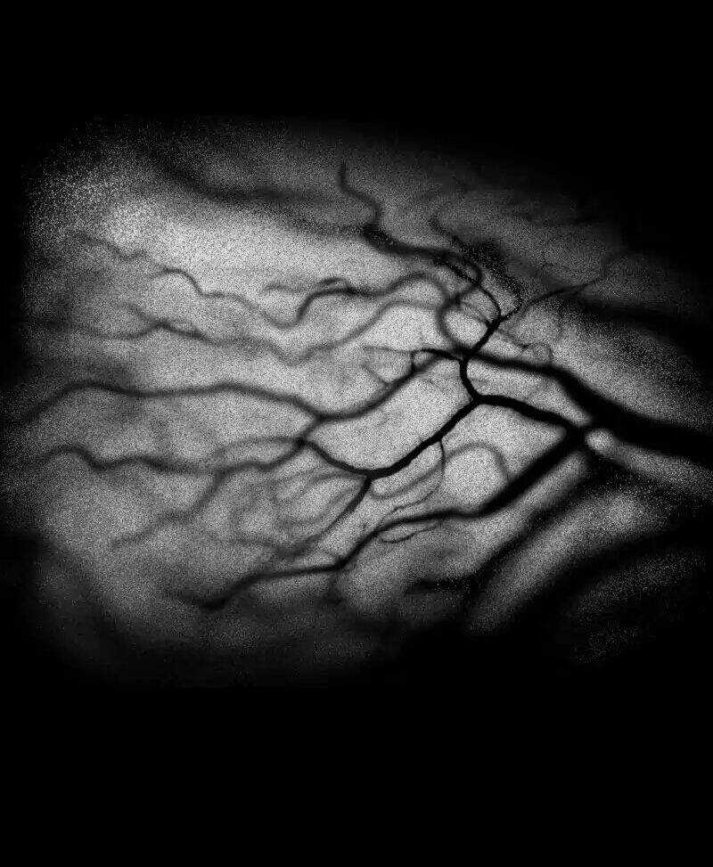 Liệu Pháp Của Melvina Chapter 26 trang 19