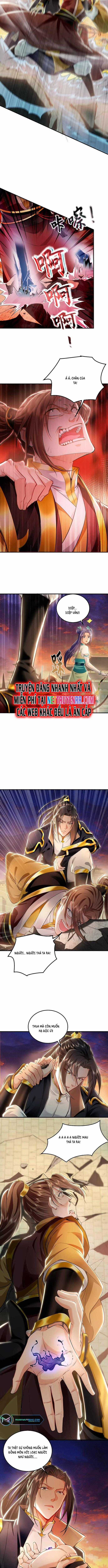 Ta Có Trăm Vạn Tốc Độ Đánh Chapter 20 trang 5