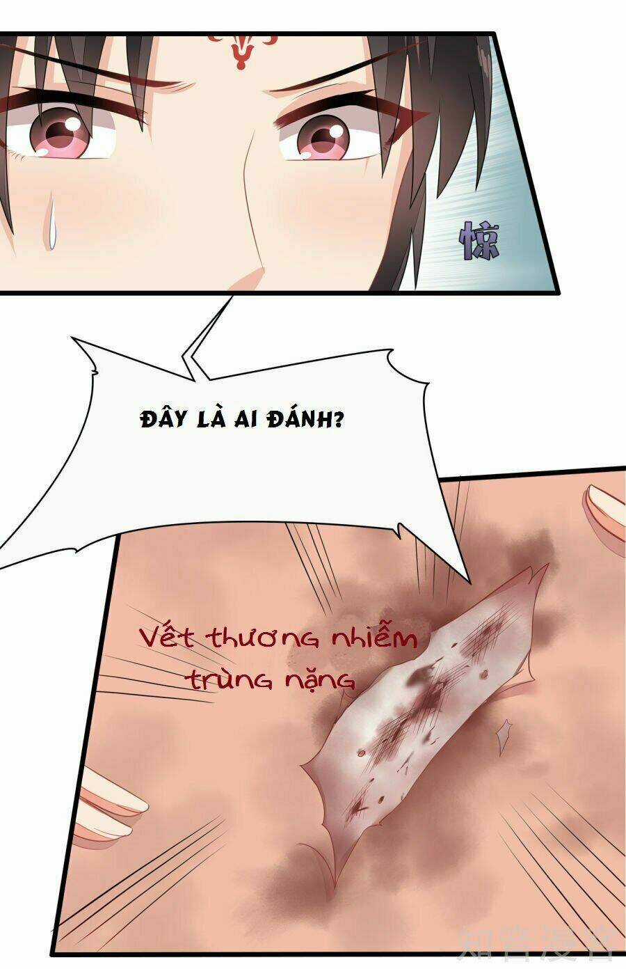 Tà Vương Thần Phi: Y Thủ Che Thiên Chapter 8 trang 17