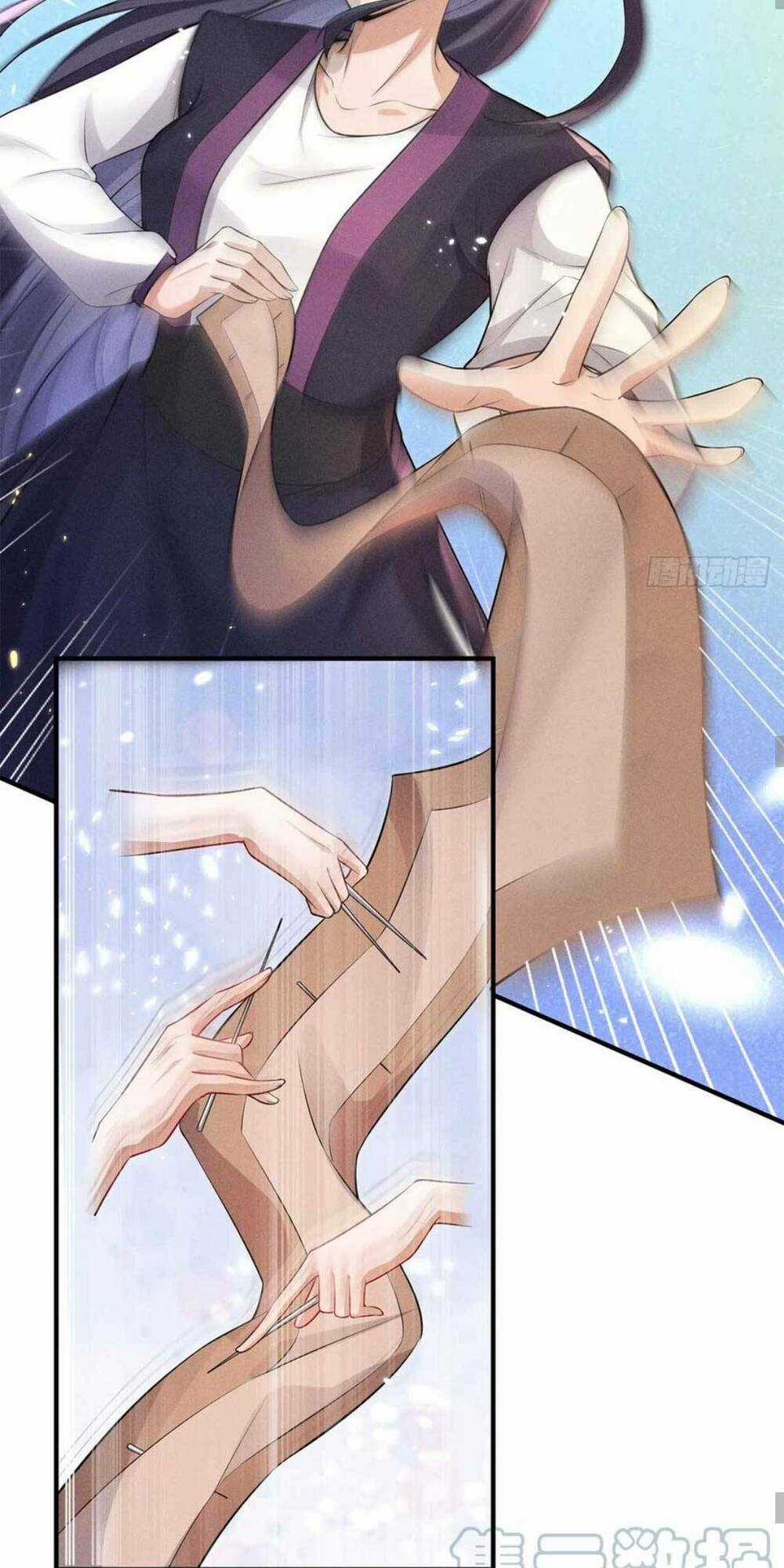 Tái Sinh Trở Lại : Ta Trở Thành Độc Y Thái Tử Phi Chapter 20 trang 30