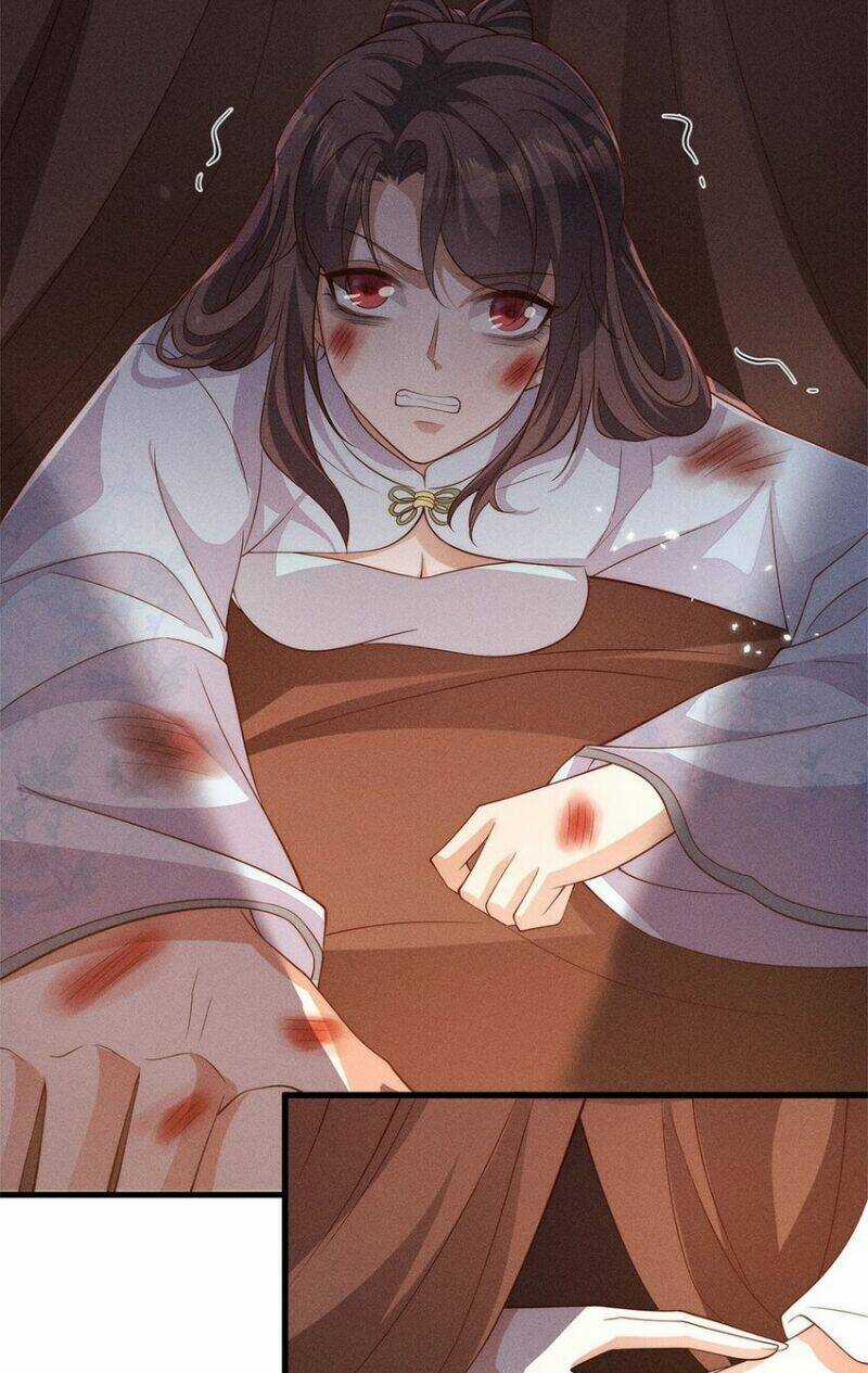 Tái Sinh Trở Lại : Ta Trở Thành Độc Y Thái Tử Phi Chapter 51 trang 50