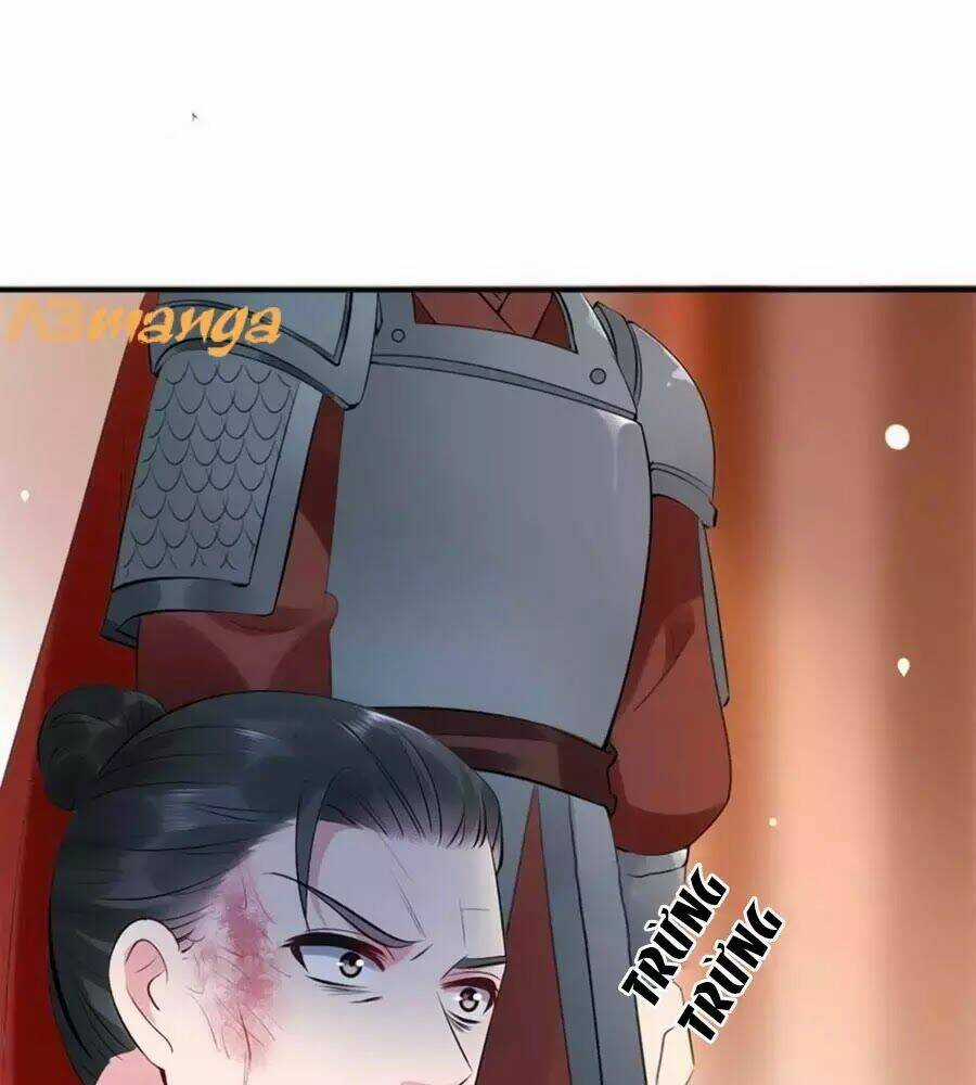 Tuyệt Thế Thần Y: Phúc Hắc Đại Tiểu Thư Chapter 34 trang 74