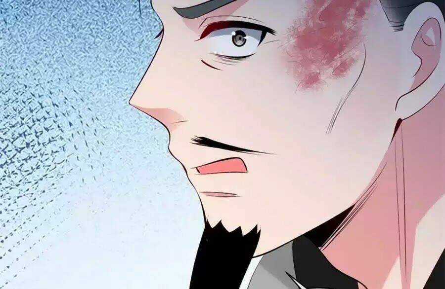 Tuyệt Thế Thần Y: Phúc Hắc Đại Tiểu Thư Chapter 34 trang 81