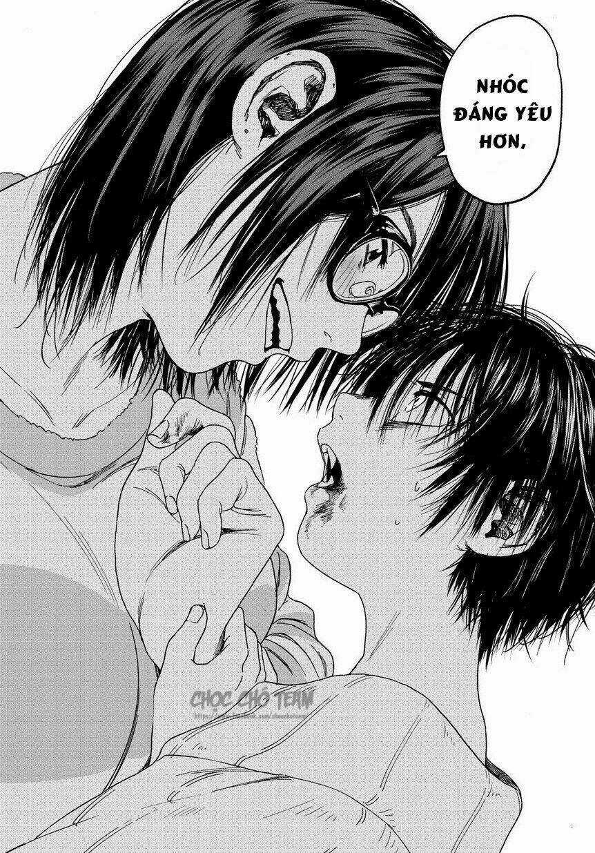 Vết Sẹo Của Cậu Bé Chapter 1 trang 31