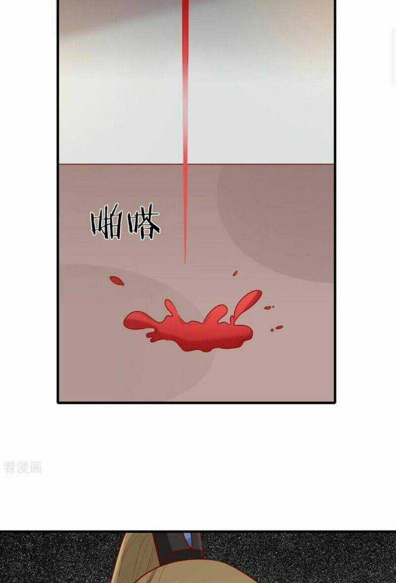 Vương Gia Người Ta Sẽ Giảm Béo Mà!!! Chapter 191 trang 8