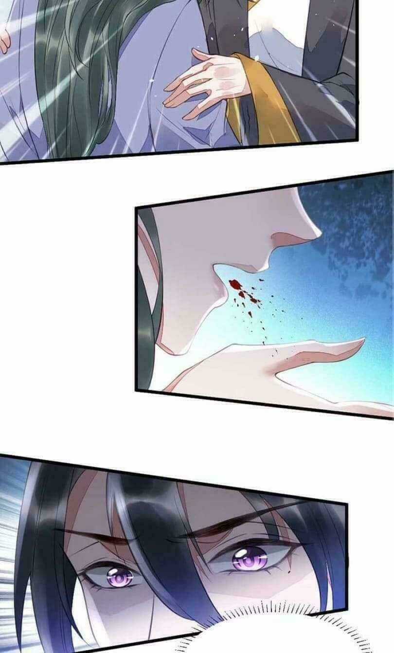 Y Phi Khuynh Thành - Vương Phi Muốn Hưu Phu Chapter 5 trang 17