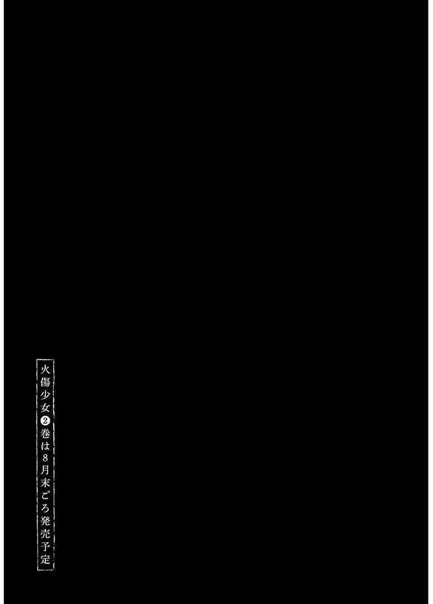 Yakedo Shoujo Chapter 6 trang 30